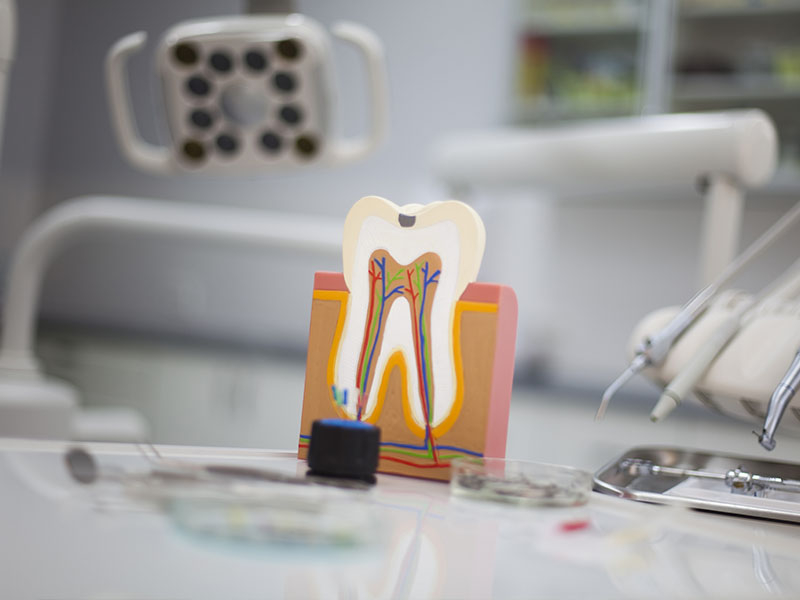 Emergency Dentist Middlesex