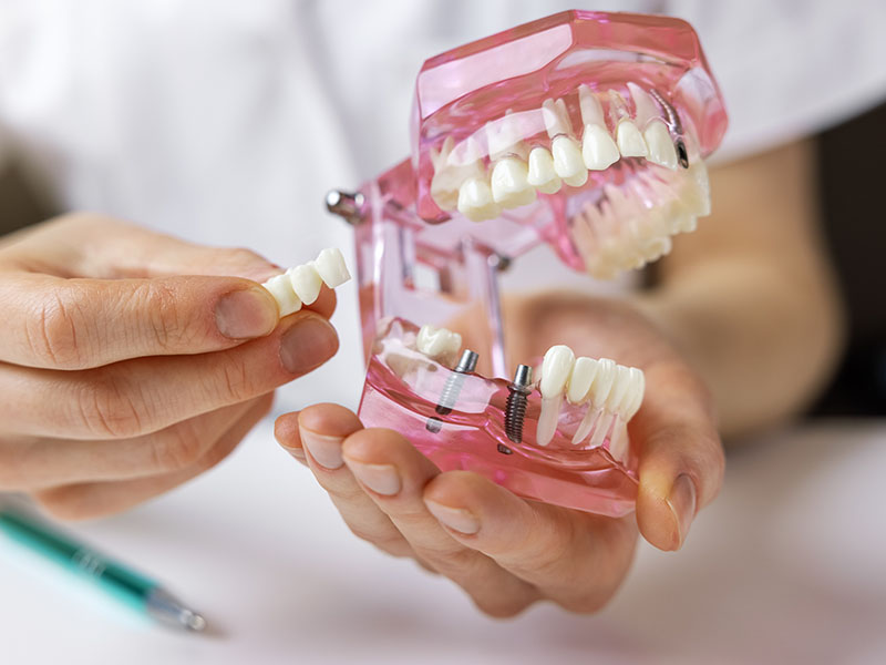 Dental Office in Middlesex