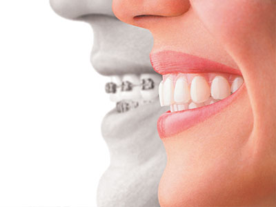 Amaltas Dental   Implant Center | Extractions, Root Canals and Sleep Apnea