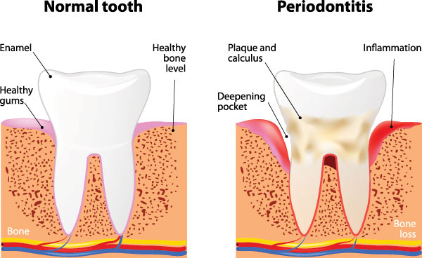 Amaltas Dental   Implant Center | Root Canals, Pediatric Dentistry and Cosmetic Dentistry