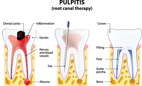 Amaltas Dental   Implant Center | Cosmetic Dentistry, Implant Dentistry and Extractions